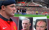 Khám phá chiếc băng đầu đặc biệt của Rooney