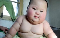 Trẻ sinh mổ dễ bị bệnh béo phì