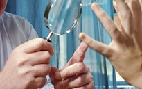 Giải phẫu đường chỉ tay để "thay đổi số mệnh"