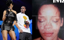 Bị bạo hành tàn nhẫn, Rihanna vẫn còn yêu bồ cũ