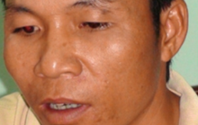 Ra đầu thú sau 10 năm chém trọng thương bạn nhậu