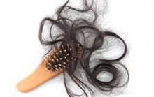Rụng tóc ở phụ nữ: Nhiều nguyên nhân