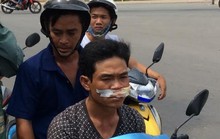 Cướp trèo tường ngã dập mặt, bị “hiệp sĩ” tóm gọn