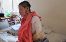 TP HCM: Đang đi, một nữ công nhân bị tạt axit