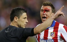 Mandzukic bị các hậu vệ Real hạ đo ván, đổ máu mặt