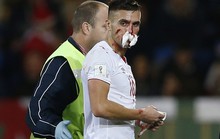 Đổ máu mũi, cầu thủ Serbia vẫn chơi hết trận