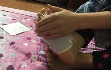 Cẩn trọng với miếng dán thải độc