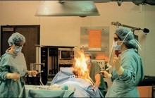 Bệnh nhân cháy nửa người vì … trung tiện trên bàn mổ