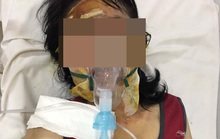 Cô giáo bị bỏng nặng ở Phú Quốc đang dần hồi phục