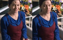 Cô gái Thái Lan biến dạng trán vì tiêm chất làm đầy