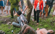 Một nghi can trộm chó dương tính với HIV
