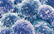 Chế tạo thành công loại virus chuyên diệt tế bào ung thư