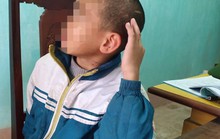 Trần tình của sư thầy bạo hành bé trai 10 tuổi thâm tím khắp người