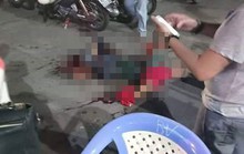 Một thanh niên bị chém lìa bàn tay