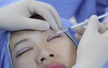 Mắt trợn ngược sau một lần cắt mí làm đẹp