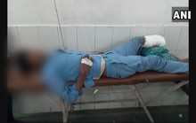 Kinh dị cảnh lấy chân bị cắt bỏ của bệnh nhân làm... gối đầu