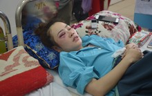 Nam thanh niên đánh phụ nữ bầm mắt vì dĩa bánh xèo