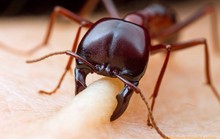 4 phương pháp chữa bệnh 'lấy độc trị độc'