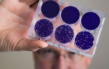 Virus bại liệt được hồi sinh để trị ung thư não