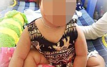 Phép mầu nào cho bé gái bị u thân não?