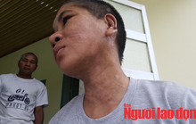 Vụ Nga vọc tra tấn dã man: Y Nhiêu khai gì với công an?