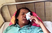 Một hiệp sĩ bị trộm chó bắn súng điện gây thương tích