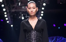 Người mẫu Kim Anh bị ung thư buồng trứng giai đoạn cuối