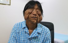 6 giờ cứu người đàn ông thoát khỏi gương mặt ông Bị