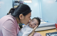 Một nụ hôn trên má mang... cả tá mầm bệnh