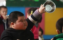 Gánh nặng kép về dinh dưỡng đe dọa nhiều nước