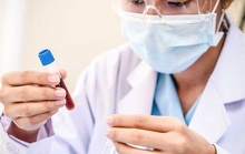 Có những kỹ thuật mới chỉ 1-2 tuần tuổi đã biết giới tính thai nhi