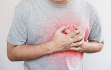 Cảnh báo đột quỵ khó ngờ từ việc... lười đánh răng!