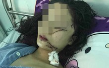Vụ cô gái xinh đẹp 18 tuổi bị rạch mặt: Công an thông tin bất ngờ về nguyên nhân
