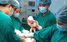 Hiếm gặp, thai phụ 9x sinh 3 cùng trứng