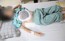 Người phụ nữ bị ngực lở loét, hoại tử do thầy lang bảo cứ chờ khối u vỡ