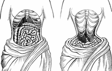 Thời trang nguy hiểm thời xưa