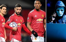 Man United khốc hại vì hacker