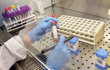 Việt Nam nghiên cứu, thử nghiệm thuốc điều trị virus corona mới trong vòng 4 tuần