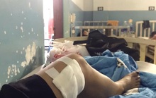 TP HCM: Nhiều người bất ngờ bị bầy chó dữ tấn công