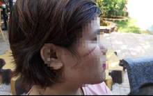 Bắt khẩn cấp nghi can chặn xe rạch mặt cô gái 26 tuổi ở Bà Rịa - Vũng Tàu