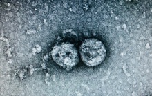 Phát hiện chủng virus SARS-CoV-2 gây dịch Covid-19 tại VN có thay đổi