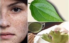 Mẹo trị nám tại nhà với lá trầu không, rẻ mà siêu hiệu quả
