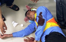 Khánh Hòa: Nhân viên Trạm thu phí BOT Ninh Xuân bị đánh trọng thương