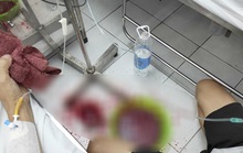 Đua thời gian với ca ộc máu dữ dội tại giường bệnh