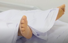 Bệnh viện Chợ Rẫy báo cáo gì cho Bộ Y tế liên quan các ca ngộ độc pate Minh Chay?