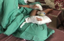 Chế tạo xe chạy bằng pin, học sinh ở Quảng Nam bị pin nổ dập nát tay