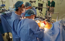 Bệnh viện Chợ Rẫy triển khai kỹ thuật mổ tim mới lần đầu tại phía Nam