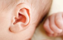 Dị dạng vành tai có phẫu thuật được không?