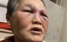 Bị hành hung tại Mỹ, cụ bà quyên góp 1 triệu USD chống phân biệt