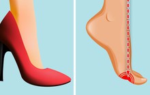 Những tác hại của việc đi giày cao gót thường xuyên